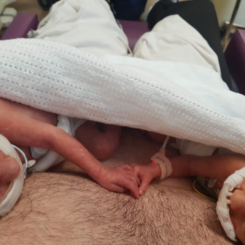 Twin boys holding hands during kangaroo care